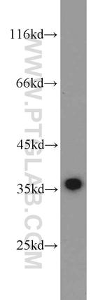 PCNA Antibody in Western Blot (WB)