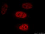 EFTUD2 Antibody in Immunocytochemistry (ICC/IF)