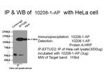 EFTUD2 Antibody in Immunoprecipitation (IP)