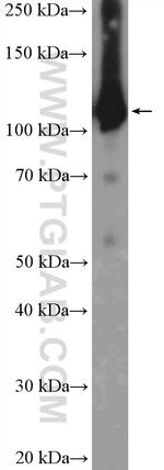 EFTUD2 Antibody in Western Blot (WB)