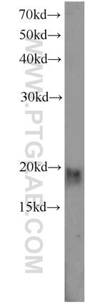 CIRBP Antibody in Western Blot (WB)