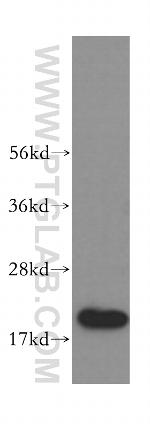 CIRBP Antibody in Western Blot (WB)