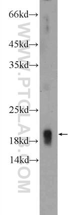 CIRBP Antibody in Western Blot (WB)