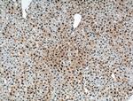 RUVBL1 Antibody in Immunohistochemistry (Paraffin) (IHC (P))