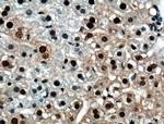 RUVBL1 Antibody in Immunohistochemistry (Paraffin) (IHC (P))