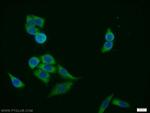 FANCG Antibody in Immunocytochemistry (ICC/IF)