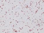 OLIG2 (Marker of Glial Brain Tumors) Antibody in Immunohistochemistry (Paraffin) (IHC (P))