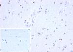 OLIG2 (Marker of Glial Brain Tumors) Antibody in Immunohistochemistry (Paraffin) (IHC (P))