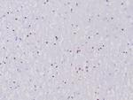 OLIG2 (Marker of Glial Brain Tumors) Antibody in Immunohistochemistry (Paraffin) (IHC (P))