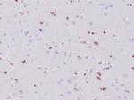 OLIG2 (Marker of Glial Brain Tumors) Antibody in Immunohistochemistry (Paraffin) (IHC (P))