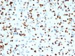 OLIG2 (Marker of Glial Brain Tumors) Antibody in Immunohistochemistry (Paraffin) (IHC (P))