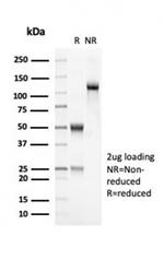 OLIG2 (Marker of Glial Brain Tumors) Antibody in Immunoelectrophoresis (IE)