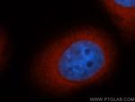 CDC37 Antibody in Immunocytochemistry (ICC/IF)