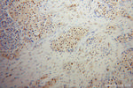 UBC9 Antibody in Immunohistochemistry (Paraffin) (IHC (P))