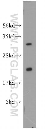 UBC9 Antibody in Western Blot (WB)