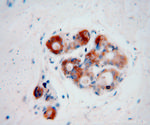 CRABP2 Antibody in Immunohistochemistry (Paraffin) (IHC (P))