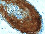 CRABP2 Antibody in Immunohistochemistry (Paraffin) (IHC (P))