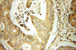 CRABP2 Antibody in Immunohistochemistry (Paraffin) (IHC (P))