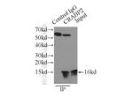 CRABP2 Antibody in Immunoprecipitation (IP)