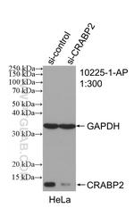 CRABP2 Antibody in Western Blot (WB)