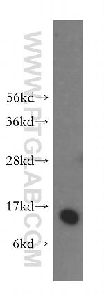 CRABP2 Antibody in Western Blot (WB)