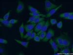 ABCF2 Antibody in Immunocytochemistry (ICC/IF)