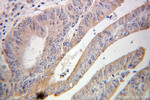 ABCF2 Antibody in Immunohistochemistry (Paraffin) (IHC (P))