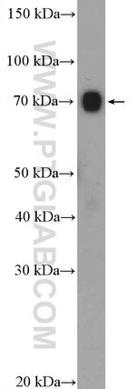 ABCF2 Antibody in Western Blot (WB)