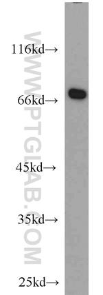 ABCF2 Antibody in Western Blot (WB)