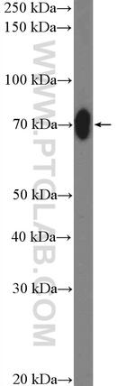 ABCF2 Antibody in Western Blot (WB)