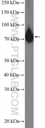 ABCF2 Antibody in Western Blot (WB)