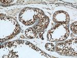 EIF2S2 Antibody in Immunohistochemistry (Paraffin) (IHC (P))