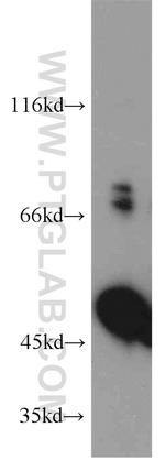 EIF2S2 Antibody in Western Blot (WB)