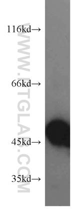 EIF2S2 Antibody in Western Blot (WB)