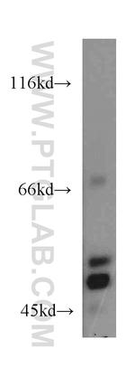 EIF2S2 Antibody in Western Blot (WB)