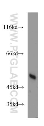 EIF2S2 Antibody in Western Blot (WB)