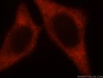 EIF2S2 Antibody in Immunocytochemistry (ICC/IF)