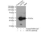 EIF2S2 Antibody in Immunoprecipitation (IP)