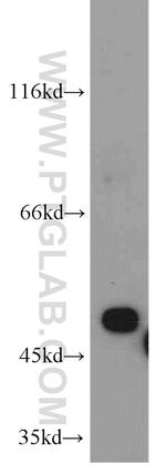 EIF2S2 Antibody in Western Blot (WB)