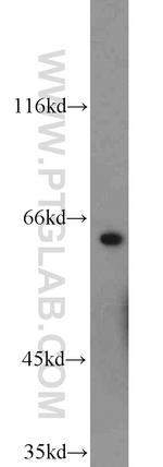 nucleobindin 1 Antibody in Western Blot (WB)