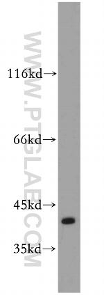 SAE1 Antibody in Western Blot (WB)