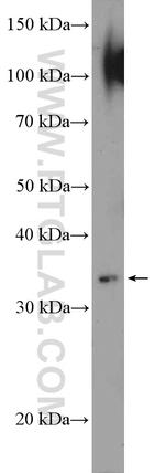 SAE1 Antibody in Western Blot (WB)