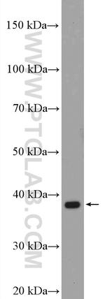 SAE1 Antibody in Western Blot (WB)