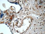 SMAD4 Antibody in Immunohistochemistry (Paraffin) (IHC (P))