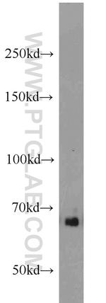 SMAD4 Antibody in Western Blot (WB)