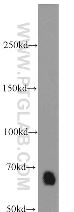 SMAD4 Antibody in Western Blot (WB)