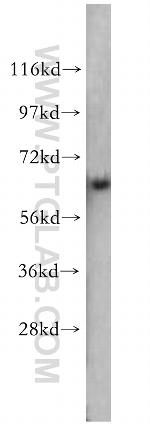 SMAD4 Antibody in Western Blot (WB)