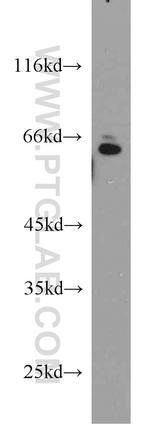 SMAD4 Antibody in Western Blot (WB)