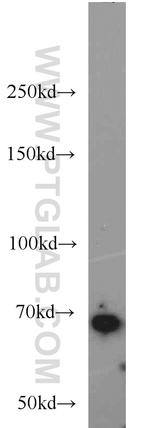 SMAD4 Antibody in Western Blot (WB)