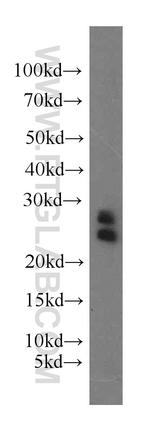 ARL2 Antibody in Western Blot (WB)